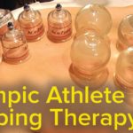 হিজামা কেন করাবেন? হিজামার স্বাস্থ্য উপকারিতা